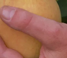 Pomme